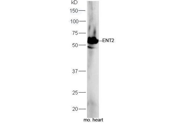 anti-Solute Carrier Family 29 (Nucleoside Transporters), Member 2 (SLC29A2) (AA 221-320) antibody