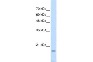 Image no. 1 for anti-YY1 Associated Factor 2 (YAF2) antibody (ABIN2460230)