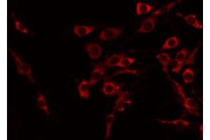 Image no. 1 for anti-Tumor Necrosis Factor (Ligand) Superfamily, Member 15 (TNFSF15) antibody (ABIN6259216)