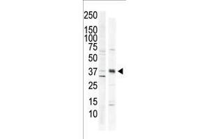 Image no. 2 for anti-Calcium/calmodulin-Dependent Protein Kinase I (CAMK1) (AA 341-370), (C-Term) antibody (ABIN391310)