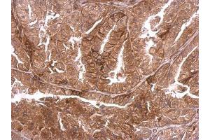 IHC-P Image DMPK antibody detects DMPK protein at membrane on mouse prostate by immunohistochemical analysis.