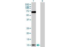Western Blot analysis of S100P expression in transfected 293T cell line by S100P MaxPab polyclonal antibody.