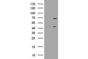 Image no. 1 for anti-Methyltransferase Like 16 (METTL16) antibody (ABIN1499433)