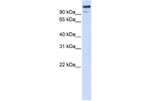 Image no. 1 for anti-Zinc Finger and BTB Domain-Containing Protein 10 (ZBTB10) (N-Term) antibody (ABIN2780256)
