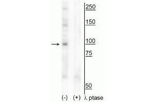 Western blot of human T47D cell lysate showing specific immunolabeling of the ~100 kDa CtIP phosphorylated at Thr847 in the first lane (-).