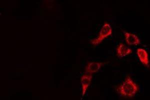 CLIP2 antibody  (C-Term)