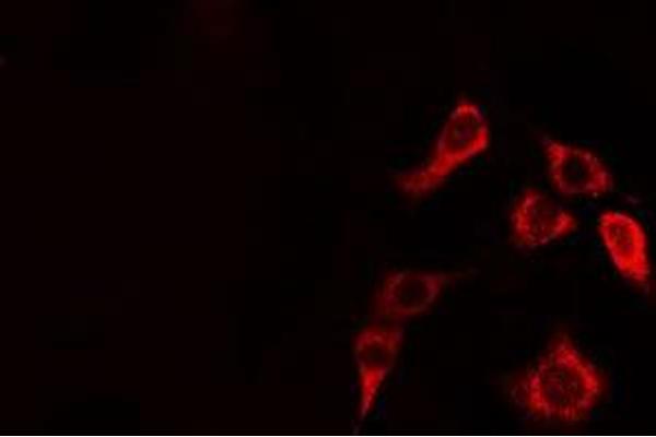CLIP2 antibody  (C-Term)