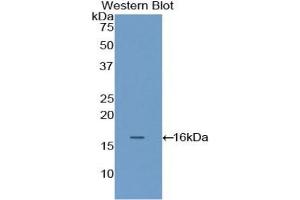 Image no. 2 for anti-Filamin B, beta (FLNB) (AA 1-237) antibody (ABIN5013559)