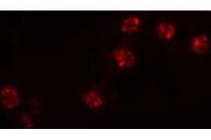 Image no. 3 for anti-Zinc Finger Protein 287 (ZNF287) antibody (ABIN6257559)