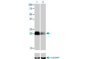 Image no. 2 for anti-Cbp/p300-Interacting Transactivator, with Glu/Asp-Rich Carboxy-terminal Domain, 1 (CITED1) (AA 94-193) antibody (ABIN561852)