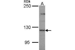 PLEKHG4 抗体  (N-Term)
