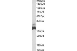 Image no. 1 for anti-rho Guanine Nucleotide Exchange Factor (GEF) 40 (ARHGEF40) (Middle Region) antibody (ABIN2774352)