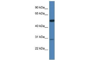 Image no. 1 for anti-Iduronate 2-Sulfatase (IDS) (N-Term) antibody (ABIN926632)