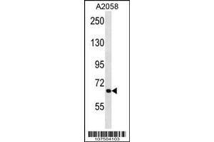 Western Blotting (WB) image for anti-ATG9 Autophagy Related 9 Homolog A (S. Cerevisiae) (ATG9A) (Center) antibody (ABIN2159354)