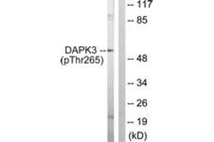 Western blot analysis of extracts from HuvEc cells, using DAPK3 (Phospho-Thr265) Antibody.