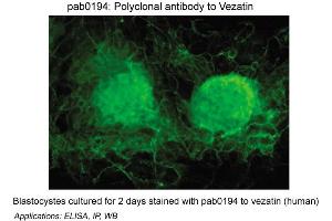 Image no. 1 for anti-Vezatin, Adherens Junctions Transmembrane Protein (VEZT) antibody (ABIN347060)