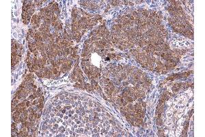 IHC-P Image Cyclin B1 antibody detects Cyclin B1 protein at cytoplasm on mouse ovary by immunohistochemical analysis.