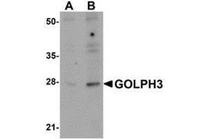 Image no. 1 for anti-Golgi phosphoprotein 3 (Coat-Protein) (GOLPH3) (N-Term) antibody (ABIN499904)