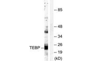 Image no. 2 for anti-Prostaglandin E Synthase 3 (Cytosolic) (PTGES3) (AA 79-128) antibody (ABIN2888705)