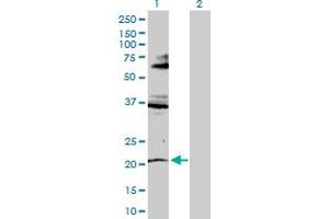 Image no. 1 for anti-Ring Finger Protein 135 (RNF135) (AA 1-210) antibody (ABIN529638)