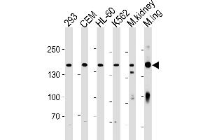 Image no. 1 for anti-Plakophilin 4 (PKP4) (AA 1040-1068), (C-Term) antibody (ABIN1881657)