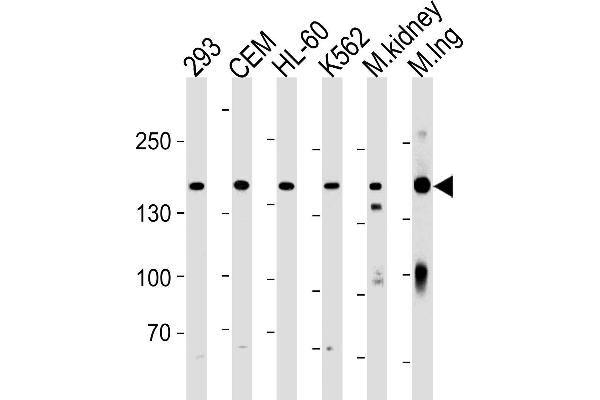 anti-Plakophilin 4 (PKP4) (AA 1040-1068), (C-Term) antibody