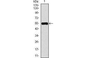Image no. 4 for anti-Calcium/calmodulin-Dependent Protein Kinase IV (CAMK4) (AA 35-292) antibody (ABIN1098144)