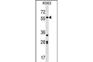 Image no. 1 for anti-SRY (Sex Determining Region Y)-Box 11 (SOX11) (AA 103-132), (N-Term) antibody (ABIN5535008)