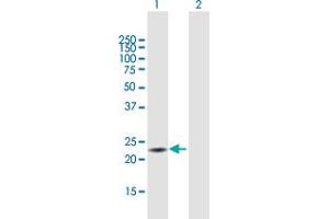 Western Blot analysis of TXNDC9 expression in transfected 293T cell line by TXNDC9 MaxPab polyclonal antibody.
