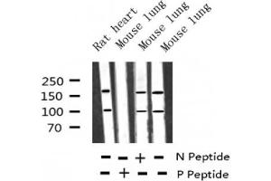 Image no. 6 for anti-Insulin-Like Growth Factor 1 Receptor (IGF1R) (pTyr1346) antibody (ABIN6256637)