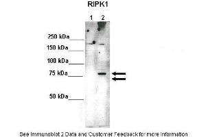 Image no. 3 for anti-Receptor (TNFRSF)-Interacting serine-threonine Kinase 1 (RIPK1) (Middle Region) antibody (ABIN2792131)