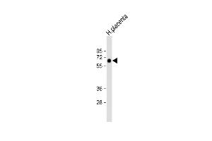 Anti-ZFP57 Antibody (Center) at 1:1000 dilution + human placenta lysate Lysates/proteins at 20 μg per lane.