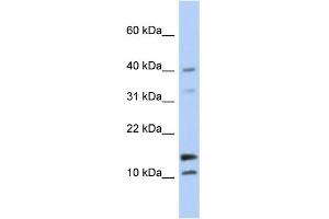Image no. 1 for anti-WAP Four-Disulfide Core Domain 5 (WFDC5) (N-Term) antibody (ABIN2785124)