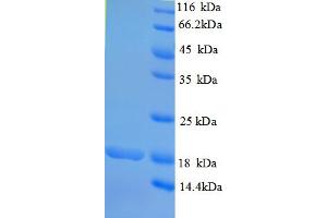 Image no. 1 for Rhomboid, Veinlet-Like 2 (RHBDL2) (AA 12-132), (partial) protein (His tag) (ABIN5710258)