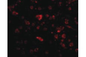Image no. 2 for anti-Mesencephalic Astrocyte-Derived Neurotrophic Factor (MANF) (C-Term) antibody (ABIN6656564)