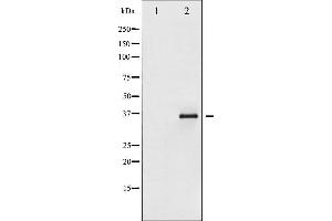 Image no. 12 for anti-Nuclear Factor of kappa Light Polypeptide Gene Enhancer in B-Cells Inhibitor, epsilon (NFKBIE) (pSer161) antibody (ABIN6255101)