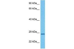 Image no. 3 for anti-MAX-Like Protein X (MLX) (C-Term) antibody (ABIN2778546)