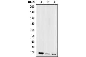 Image no. 1 for anti-Secretoglobin, Family 2A, Member 2 (SCGB2A2) (Center) antibody (ABIN2706503)