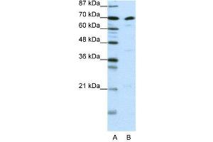 Image no. 2 for anti-Interleukin enhancer-binding factor 3 (ILF3) (N-Term) antibody (ABIN2780867)