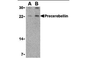 CBLN1 antibody  (Middle Region)
