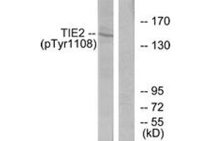Western blot analysis of extracts from NIH-3T3 cells, using TIE2 (Phospho-Tyr1108) Antibody.