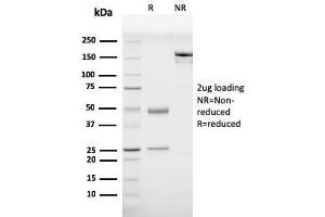 Image no. 1 for anti-Prohibitin (PHB) (AA 167-261) antibody (ABIN6940300)