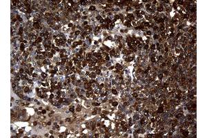 Image no. 2 for anti-Non-Metastatic Cells 1, Protein (NM23A) Expressed in (NME1) antibody (ABIN1499754)