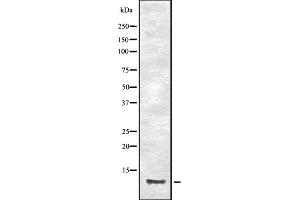 Image no. 1 for anti-Chemokine (C-C Motif) Ligand 23 (CCL23) antibody (ABIN6259112)