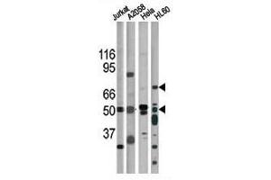 Image no. 2 for anti-Checkpoint Kinase 1 (CHEK1) (pSer317) antibody (ABIN389543)
