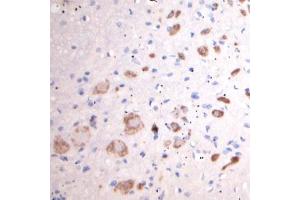 Image no. 14 for anti-Solute Carrier Family 18 (Vesicular Acetylcholine), Member 3 (SLC18A3) (Internal Region) antibody (ABIN571639)