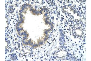 Image no. 2 for anti-Kelch Domain Containing 8A (KLHDC8A) (C-Term) antibody (ABIN2779132)