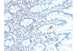 Image no. 3 for anti-BMI1 Polycomb Ring Finger Oncogene (BMI1) (AA 142-326) antibody (ABIN6940580)
