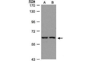 Image no. 2 for anti-Fibroblast Growth Factor Receptor Substrate 2 (FRS2) (Center) antibody (ABIN2855603)