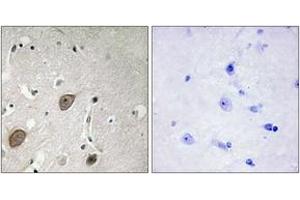 anti-Brain-Enriched Guanylate Kinase-Associated (BEGAIN) (AA 511-560) antibody